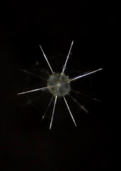 Protozoa Radiolaria Radiozoa Acantharia Acanthochiasma Images UK