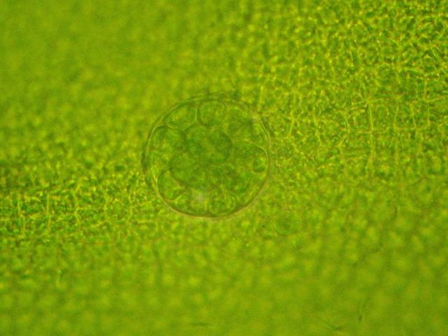 Halochlorococcum moorei - A parasitic green algae on Blidingia minima ...